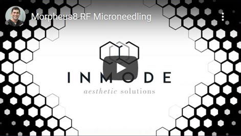 Video on Morpheus8 RF Microneedling Click to See