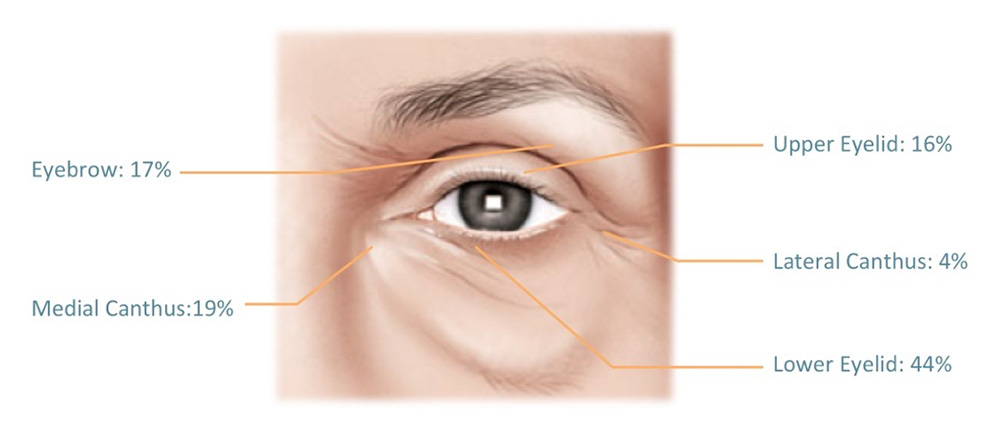 Graphic of the eye depicting the risk likelihood of various cancers.