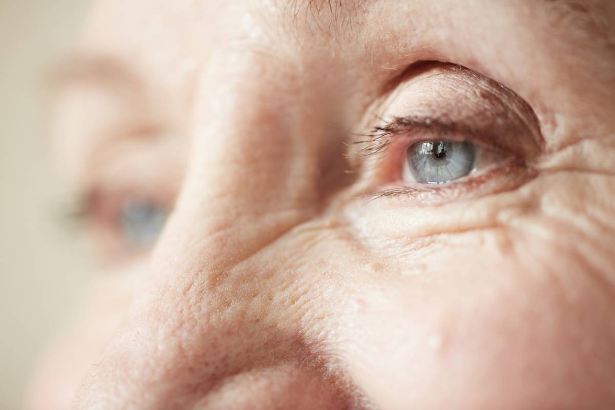 Featured image for What Does Eyelid Cancer Look Like?