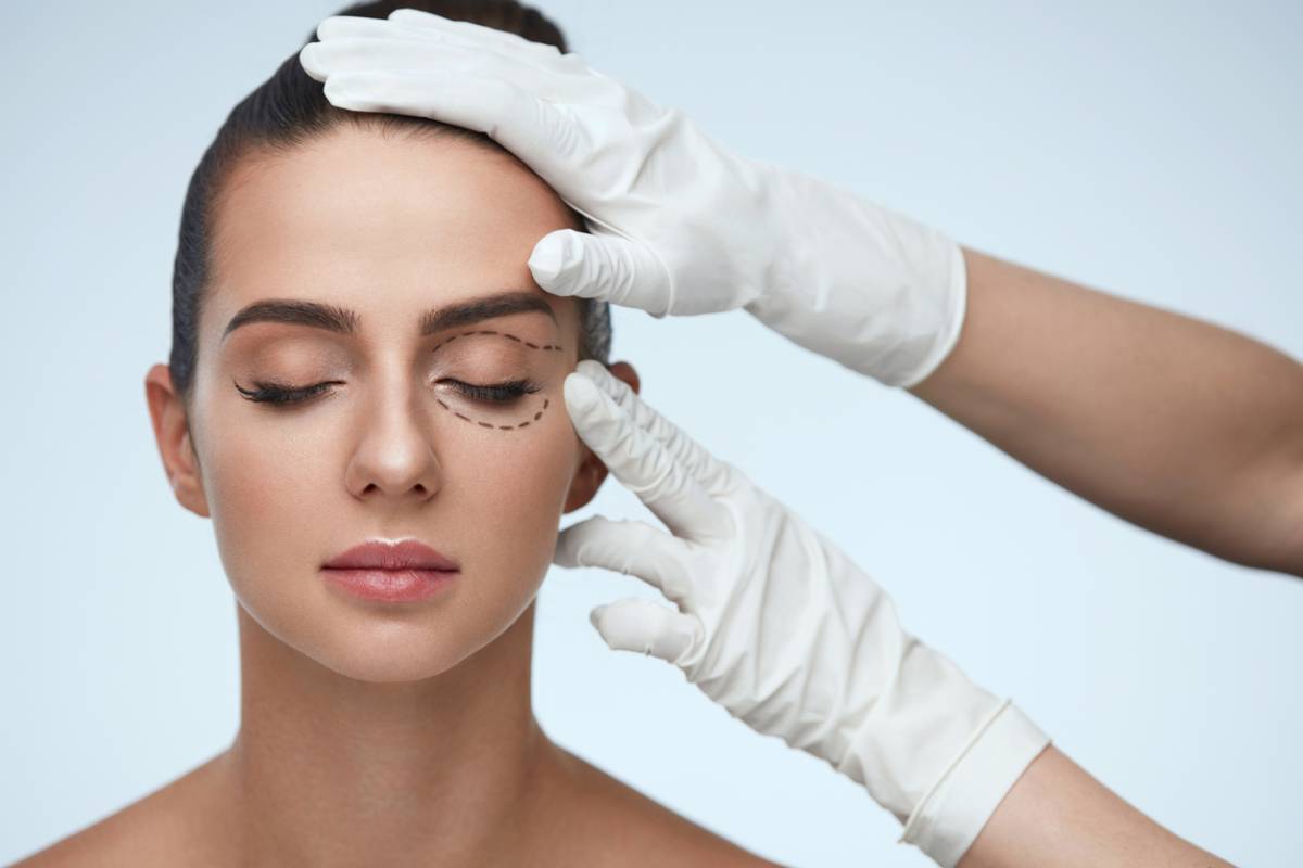 What to Know Before Your Eyelid Lift - Dr. Joseph - Oculoplastic Blog